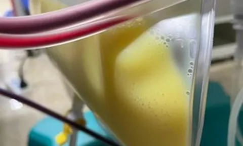 Người phụ nữ 30 tuổi "máu trắng đục như sữa" vì thói quen nhiều người mắc mà không hay