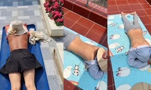 Cảnh báo nguy cơ sức khỏe từ trào lưu "phơi nắng giữa trưa"