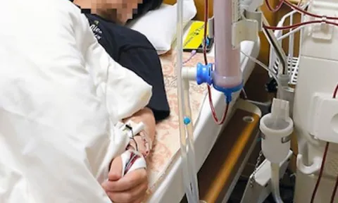 Bé trai 14 tuổi đã suy thận, bác sĩ cảnh báo 3 món quen thuộc "vạn người mê"